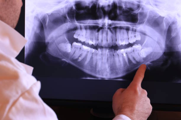 Best Cracked Tooth Emergency Dentist  in Wylie, TX